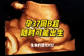 孕37周B超，宝宝随时都可能出生，孕妈妈出门一定要有人陪同