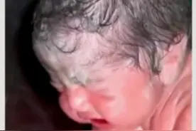 刚出生的婴儿没有啼哭和心跳，医生立马对他展开了急救图片