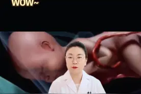 宝宝出生时为什么哭？会痛吗？#科普一下 #每天跟我涨知识 #宝妈必看 #硬核健康科普行动