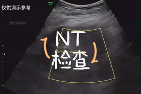 什么是NT检查 #创作灵感 一个视频告诉#新手孕妈 什么是NT检查视频封面