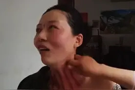 揪脖子痧。视频封面