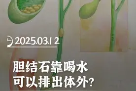 胆结石靠喝水可以排出体外？ #医学科普 #胆结石