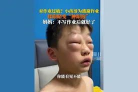 7月10日，河南焦作。#小孩哥为逃作业上演苦肉计，揉眼睛变“肿眼泡”，妈妈：不写作业一会儿就缓解了！视频封面