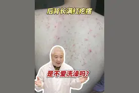 天气一热，后背就会长密密麻麻的红疙瘩，有时还伴有瘙痒！这可能是真菌感染引起是#马拉色菌毛囊炎 ，越抠长越多！#抖出健康知识宝藏 #变美 #痘痘 #夏天视频封面