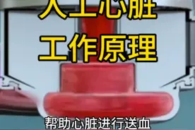 人工心脏的工作原理#人工心脏 #心力衰竭 #心脏病 #医学科普视频封面