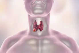 甲状腺4B穿刺出来良性几年后恶性图片