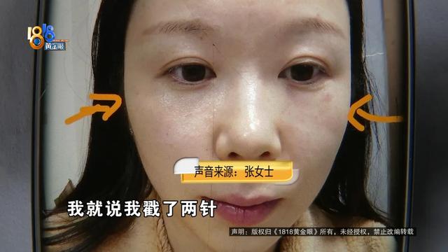 胶原蛋白导入脸部一次多少钱 2026年胶原蛋白导入脸部有副作用? 胶原蛋白导入脸部一次多少钱 2026年胶原蛋白导入脸部有副作用?