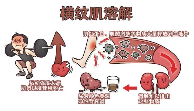 上海男子健身，竟尿出“酱油”医生警告:这三个信号是身体在求救