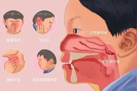 倪海厦：腺样体肥大是渣男，一个中成药，束手就擒！图片