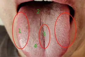 像这种舌头，都是拖出来的病，吃再多逍遥丸也没用！图片