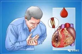 冠心病心绞痛艾灸哪些穴位好？巧用艾灸治疗冠心病，艾灸穴位指南图片