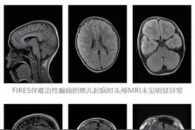 苏州首例！图片