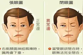 【健康科普】寒风乍起防“面瘫”图片