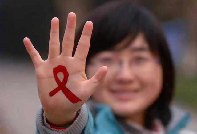 女人若是感染了“艾滋病”，胳膊上或有4种症状，都以为是皮肤病