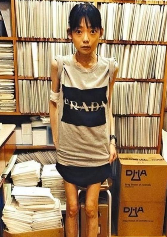 豪门玩物	，几年被折磨成牙齿全脱落，不足80斤，似骷髅	，惨不忍睹