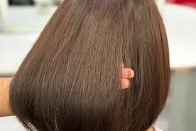 女子染完头发回来，发现头上不舒服，网友：可能是脂溢性皮炎图片