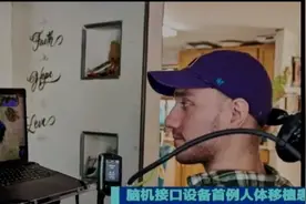 机械飞升? 马斯克：第二位人类患者成功植入脑接图片