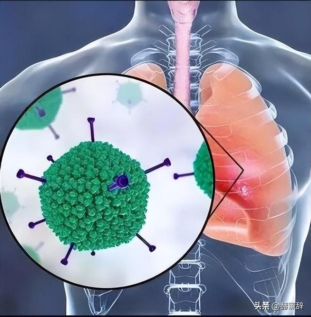 “尼帕病毒	”来势汹汹	，呼吁：每家备好5样东西，关键时刻能救命