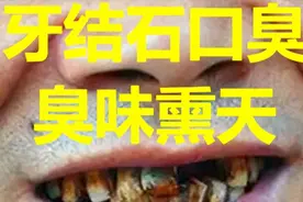 学会以下三个去臭小妙招，不仅低成本还能去除烟渍口臭！图片