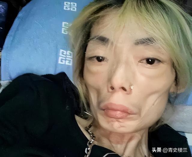 豪门玩物，8年被折磨成牙齿全掉，不足80斤，形似骷髅，惨不忍睹