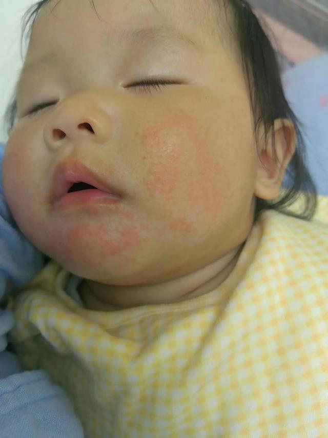 孩子米过敏广东家长还花样做米饭，医生怒了：一辈子不吃米死不了