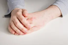 每年春天，无法入睡是最可怕的记忆，今年我自愈了季节性过敏图片