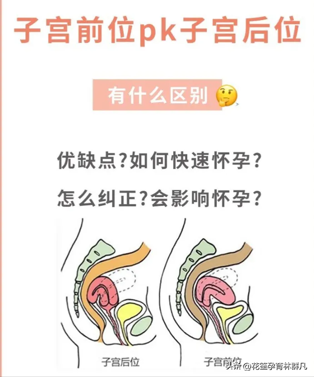 林群凡主任聊好孕：女性子宫前位VS子宫后位，揭开受孕率神秘面纱