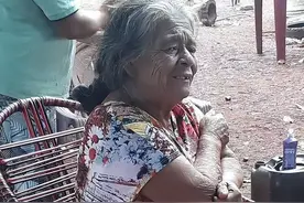 巴西81岁老妇的腹中取出了“石宝宝”，已怀了56年，手术后去世图片