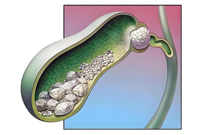 医生提醒：若长期一天只吃两顿饭，用不了半年，或患上这4种疾病