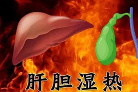 肝胆湿热，这个中成药比龙胆泻肝丸强！既清肝胆热，也能利脾胃湿图片
