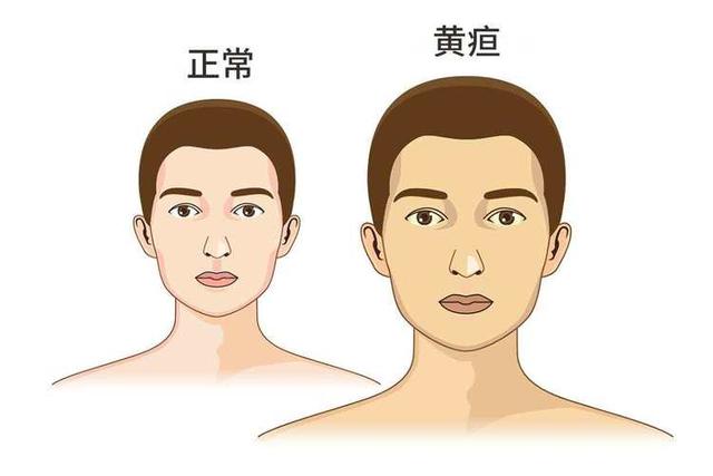 乳腺癌晚期多因啥离世？医生透露：身体出现这些症状时就该警惕