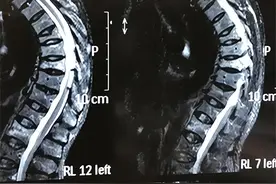 ​65岁阿姨每天在太阳底下“吸阳气”，1年后体检，医生看完都惊讶图片