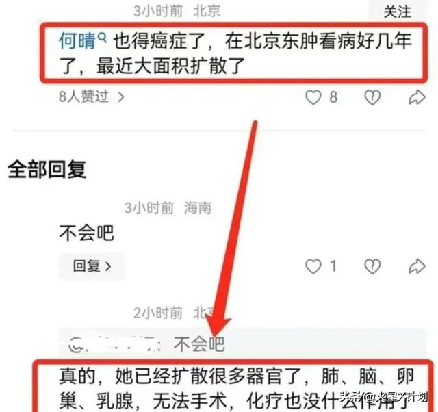 何晴住院照曝光，瘦了也浮肿了	，与过往判若两人，好友曝去世细节