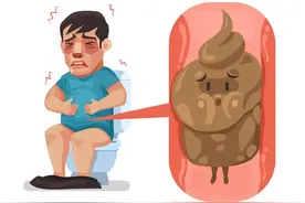 肛肠科医生告诉你，3个有效缓解便秘的方法图片