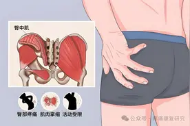 屁股疼痛是咋回事？重点关注这 7 种病！图片