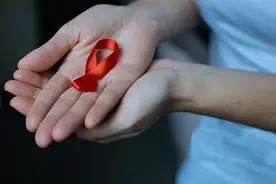 感染艾滋病，“潜伏期”是多久？多数人或误以为是皮肤病图片
