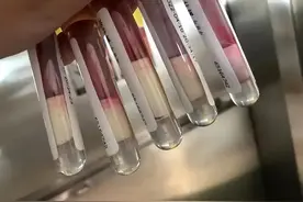 医生一再强调:血脂值没超这个数，不用太过小心，正常吃喝就可以图片