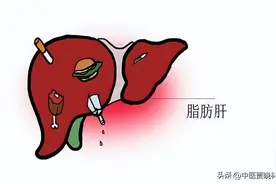 送你“一脂三消”的中成药，脂肪肝“克星”，强过逍遥丸和二陈丸图片