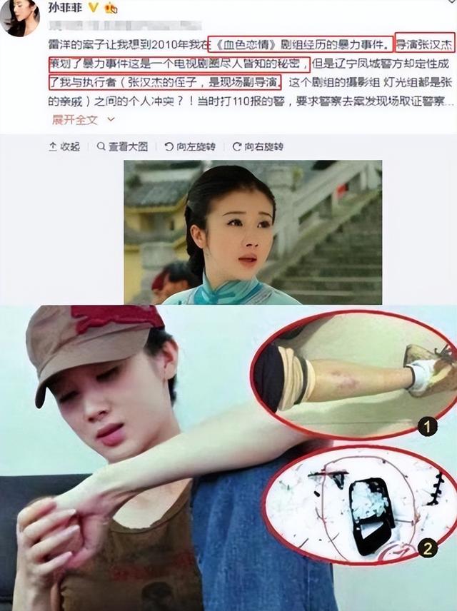 陪睡陪玩是冰山一角？又一女演员曝内娱潜规则，原来岳云鹏没说谎