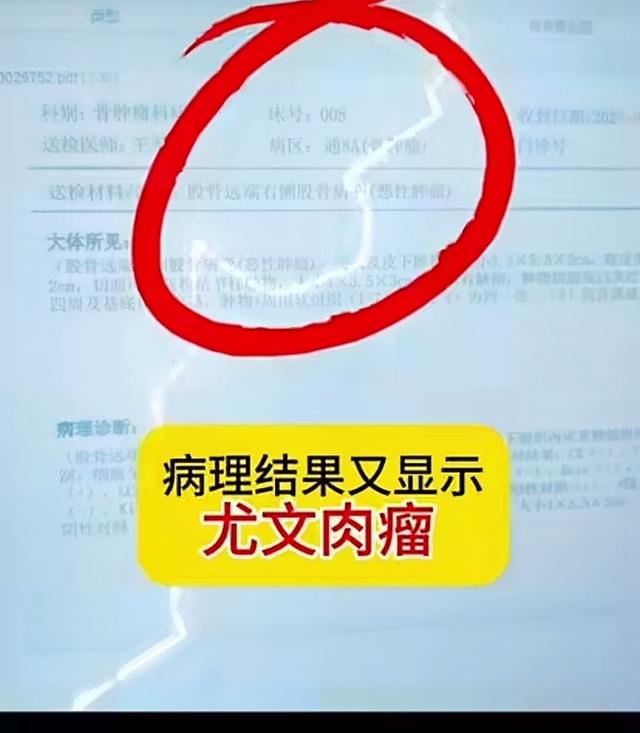 云南女生结婚15天确诊癌症！长得很漂亮，丈夫一个举动太感人了。