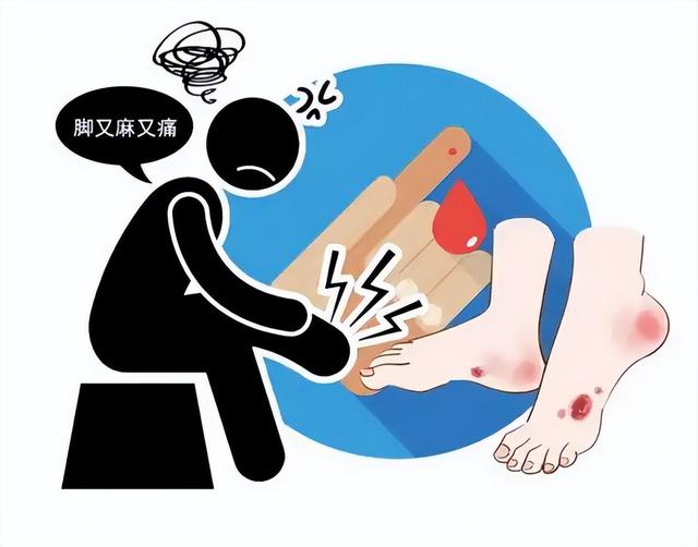 糖尿病足都有什么症状？需要注意什么？内分泌科医生一文详解