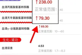 转氨酶200了有危险吗？医生告诉你实话！图片