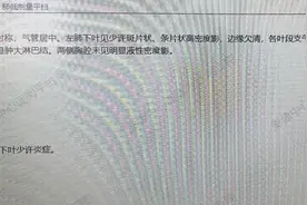 治疗无效反加重！8岁男孩的咳嗽迷局：支原体肺炎为何越治越凶？图片