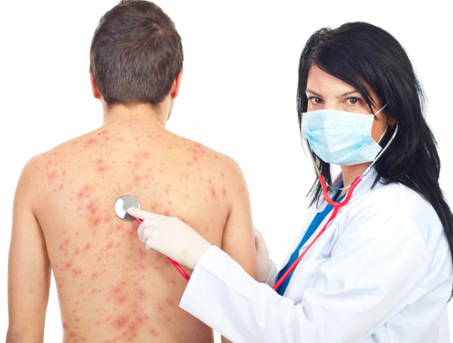 医生调查450名带状疱疹患者，惊讶发现：患病的人，有3个共同点