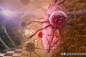 癌症患者不手术不化疗，最长能活多久？肿瘤医生讲了实话图片