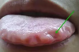 舌头一圈齿痕，一健脾二疏肝三扶阳，3个中成药，调肝健脾补肾图片