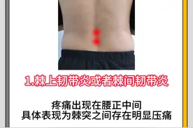 4种常见腰疼，医生教你搞懂病因!图片
