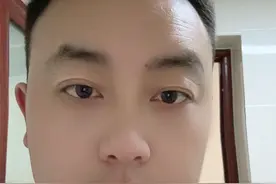 我的肾移植经历2图片