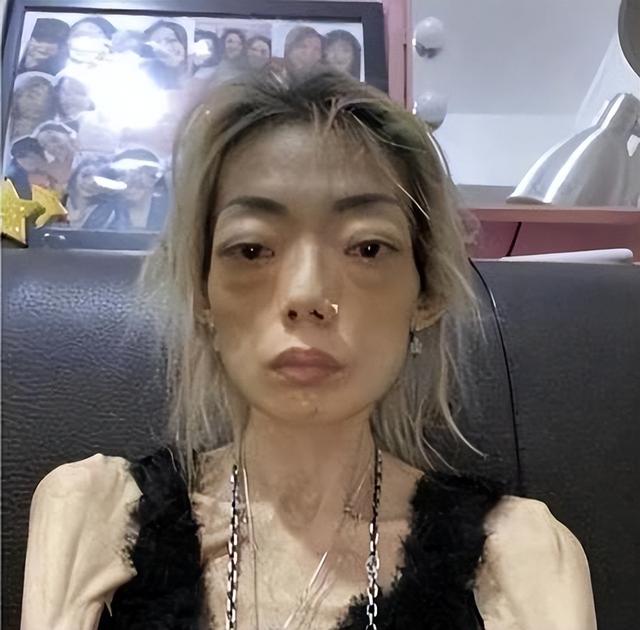 豪门玩物，几年被折磨成牙齿全脱落	，不足80斤，似骷髅，惨不忍睹