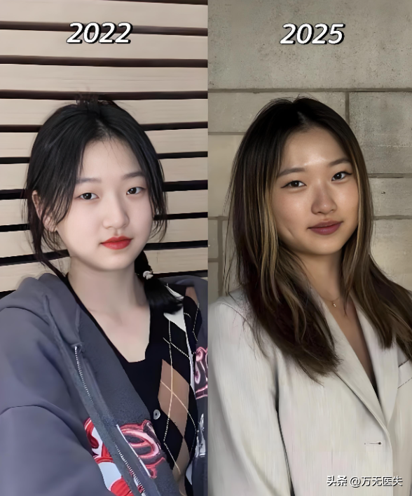 留学一年嘴都变大了	，女学生面相变化图走红，牢A果然权威